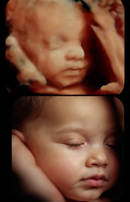 8k Ultrasound Photo